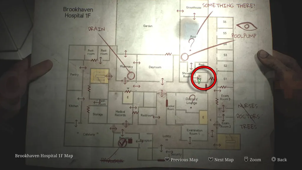 Silent Hill 2 remake orvosi cső helyét